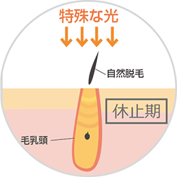 ハイパースキン法イメージ画像