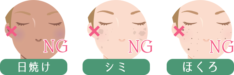 日焼け、シミ、ほくろ
