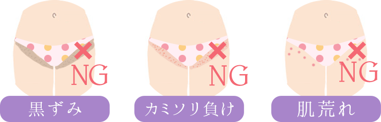 黒ずみ、カミソリ負け、肌荒れ