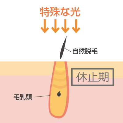 ハイパースキン法イメージ画像