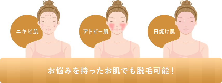 肌トラブルイラスト